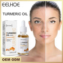 1+1 GRATIS | Aceite Esencial de Cúrcuma™ (EELHOE)-Chumita Shop.