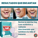 Carilla *PROMO DENTAL OFERTA DE 2X1 + ENVIO GRATIS 🎁