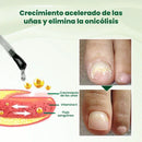 Serum de crecimiento y reparación de uñas