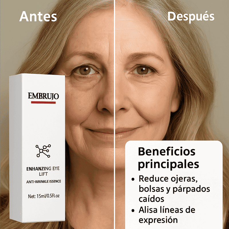 (OFERTA 2X1) Enhancing Eye Lift™ - Elimina Ojeras y Bolsas Rápidamente - EMBRUJO® (2025)